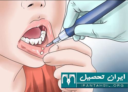 شرایط اخذ معافیت نظام وظیفه دهان و دندان