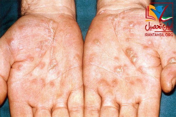 معافیت پزشکی بیماری های پوستی