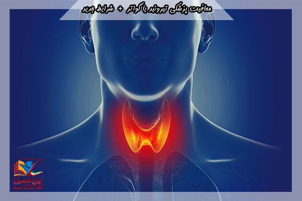 معافیت سربازی گواتر
