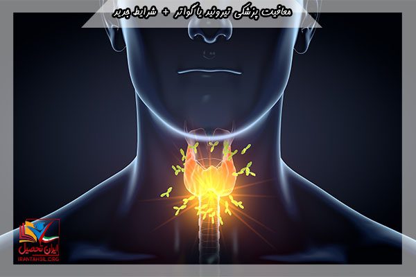 نحوه دریافت معافیت پزشکی تیروئید