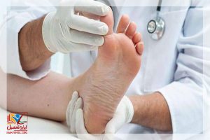 معافیت پزشکی نقرس