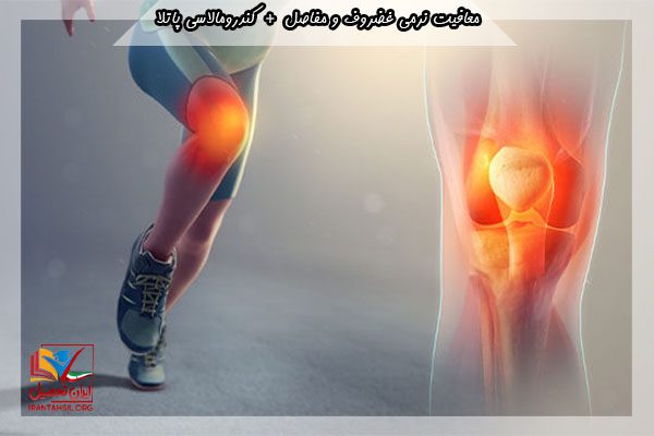 معافیت سربازی نرمی مفاصل