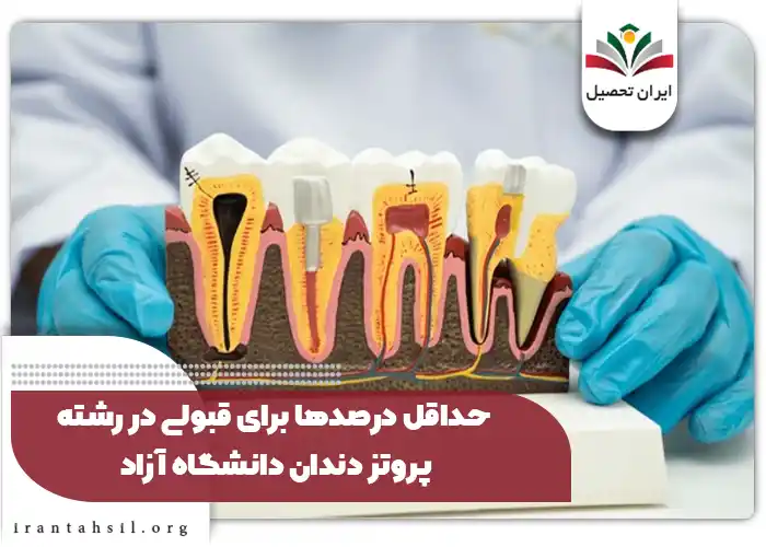 حداقل درصدها برای قبولی در رشته پروتز دندان دانشگاه آزاد