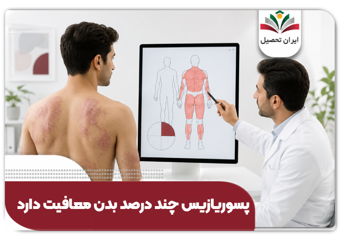 پسوریازیس چند درصد بدن معافیت دارد